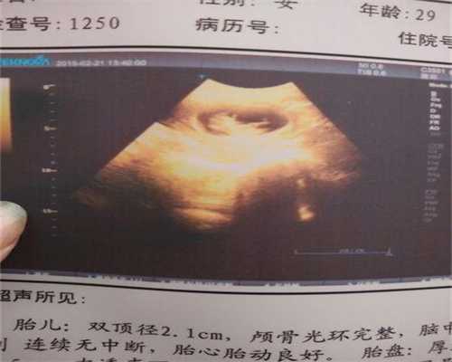 北京妇幼生孩子多少钱：男性喝浓茶影响代孕吗